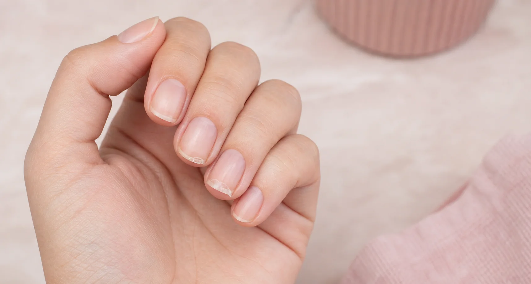 Unhas naturais curtas com descamação leve em camadas na borda livre